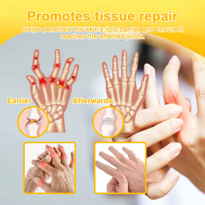 (🔥LAST DAY SALE - 80% OFF) 🐝Yagoo™ Botulinum & Bee Essence Pain Relief Bone Healing Cream
