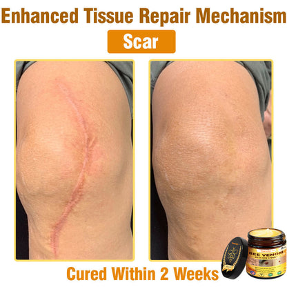 Tiworld™ Bee Venom All-in-One Cream 👩‍⚕️US Dermatologist Approved