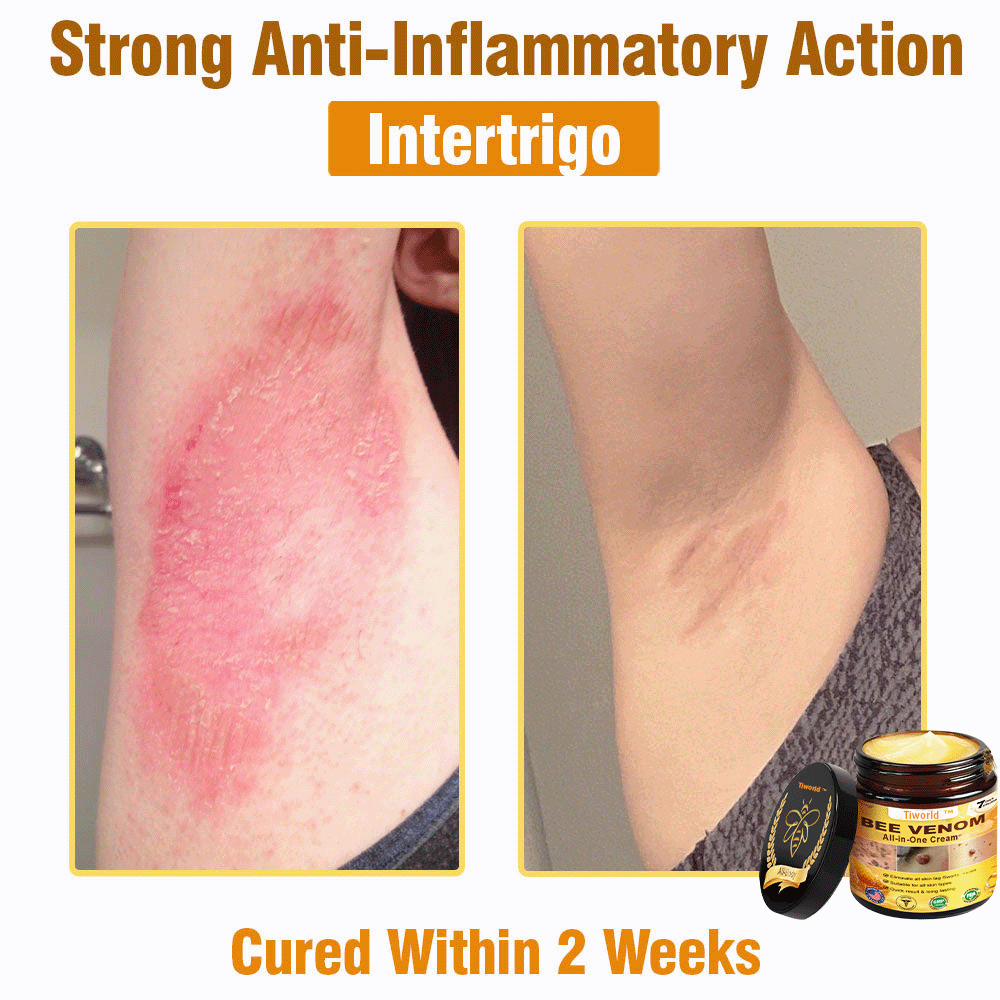 Tiworld™ Bee Venom All-in-One Cream 👩‍⚕️US Dermatologist Approved