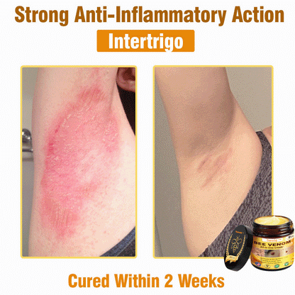 Tiworld™ Bee Venom All-in-One Cream 👩‍⚕️US Dermatologist Approved