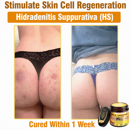 Tiworld™ Bee Venom All-in-One Cream 👩‍⚕️US Dermatologist Approved