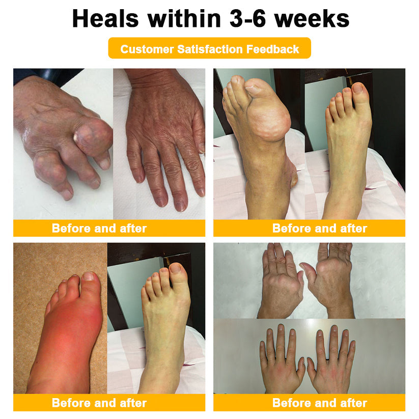 (🔥LAST DAY SALE - 80% OFF) 🐝Yagoo™ Botulinum & Bee Essence Pain Relief Bone Healing Cream