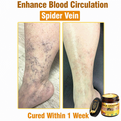 Tiworld™ Bee Venom All-in-One Cream 👩‍⚕️US Dermatologist Approved