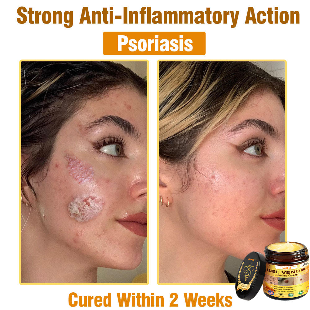 Tiworld™ Bee Venom All-in-One Cream 👩‍⚕️US Dermatologist Approved