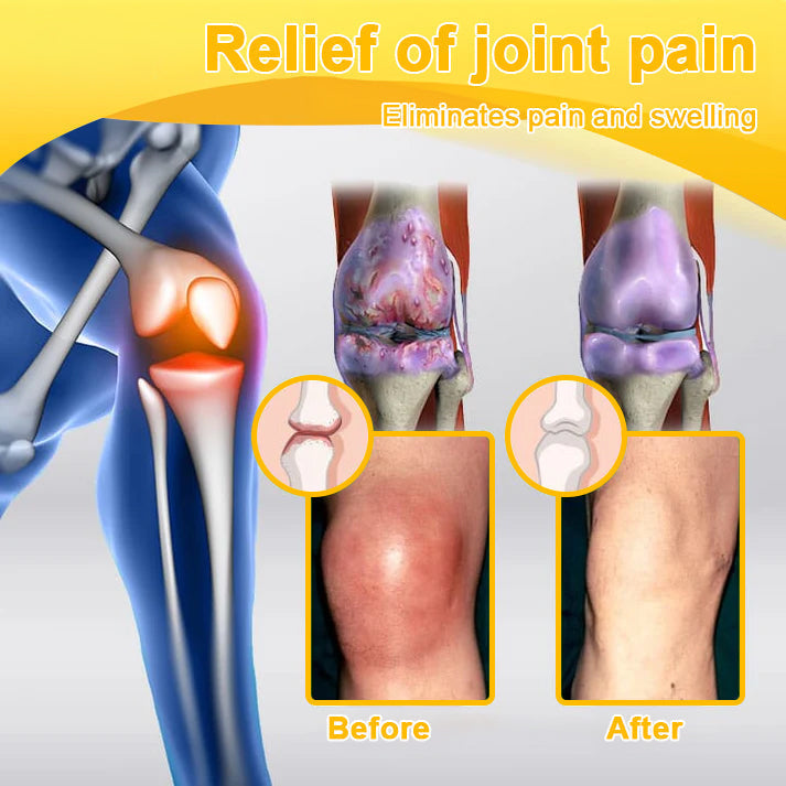 (🔥LAST DAY SALE - 80% OFF) 🐝Yagoo™ Botulinum & Bee Essence Pain Relief Bone Healing Cream