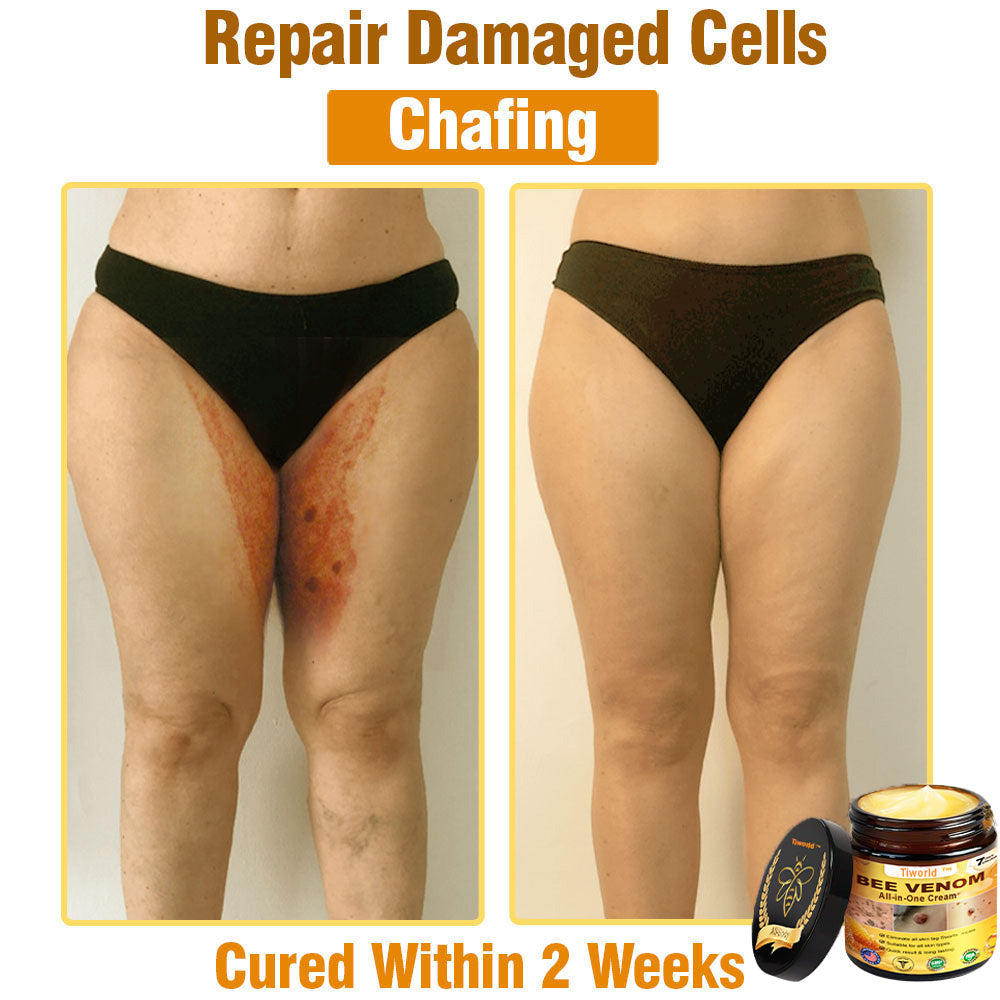 Tiworld™ Bee Venom All-in-One Cream 👩‍⚕️US Dermatologist Approved