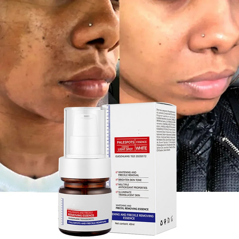 ✨FLASH SALE：⚡5-second brightening rescue: Dark spots disappear, blemishes fade, and skin becomes radiant! Vitamin C Whitening Freckles ESSENCE