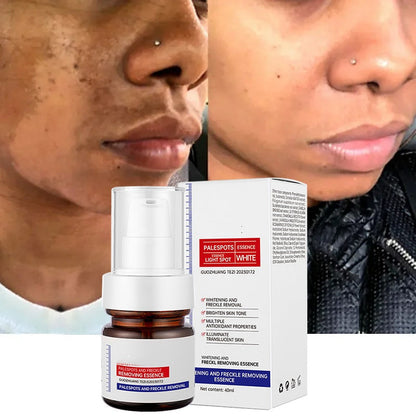 ✨FLASH SALE：⚡5-second brightening rescue: Dark spots disappear, blemishes fade, and skin becomes radiant! Vitamin C Whitening Freckles ESSENCE