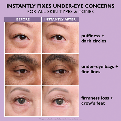 Final 3 Hours: 70%OFF✨Instant Eye Tightener Easy-Wear Formula With Brush Free!